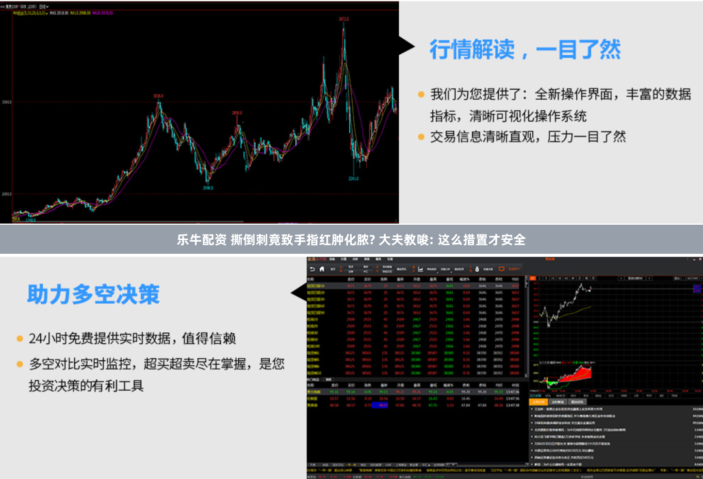 乐牛配资 撕倒刺竟致手指红肿化脓? 大夫教唆: 这么措置才安全